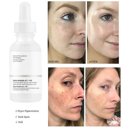 The Ordinary Alpha Arbutin 2% + HA | Dark Spot Correcting Serum
